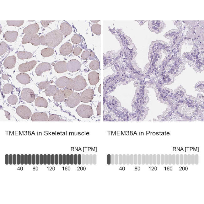 TMEM38A Antibody in Immunohistochemistry (IHC)