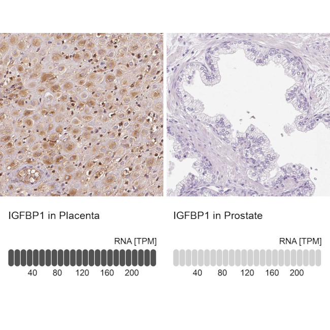 IGFBP-1 Antibody in Immunohistochemistry (IHC)