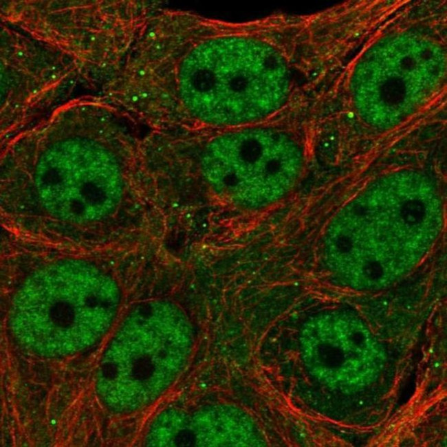 TET3 Antibody in Immunocytochemistry (ICC/IF)