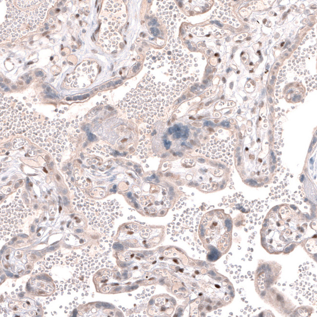 TET3 Antibody in Immunohistochemistry (IHC)