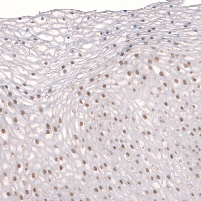 TET3 Antibody in Immunohistochemistry (IHC)