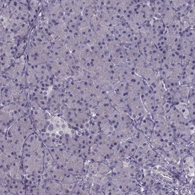 PNMT Antibody in Immunohistochemistry (IHC)