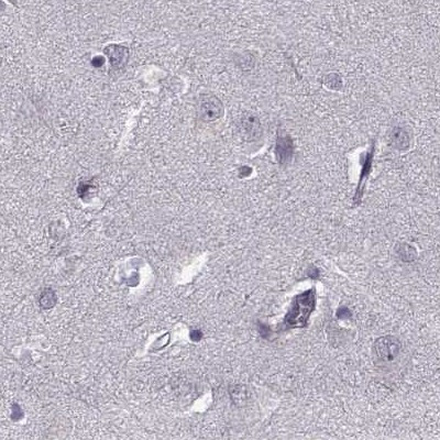 PNMT Antibody in Immunohistochemistry (IHC)