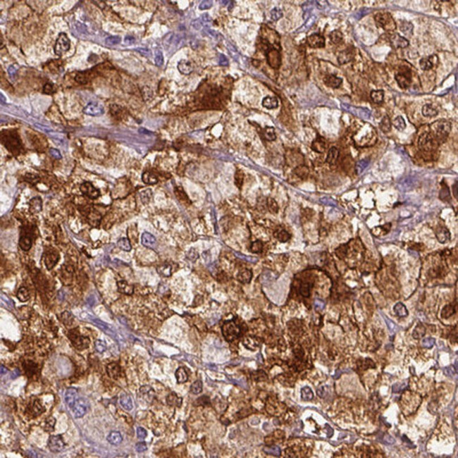 PNMT Antibody in Immunohistochemistry (IHC)