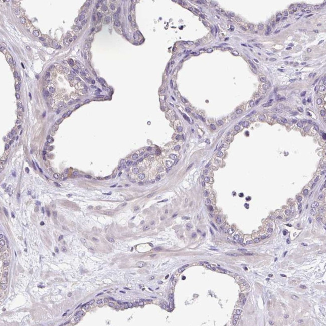 LMOD2 Antibody in Immunohistochemistry (IHC)