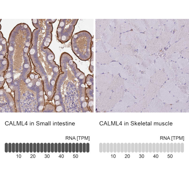 CALML4 Antibody in Immunohistochemistry (IHC)