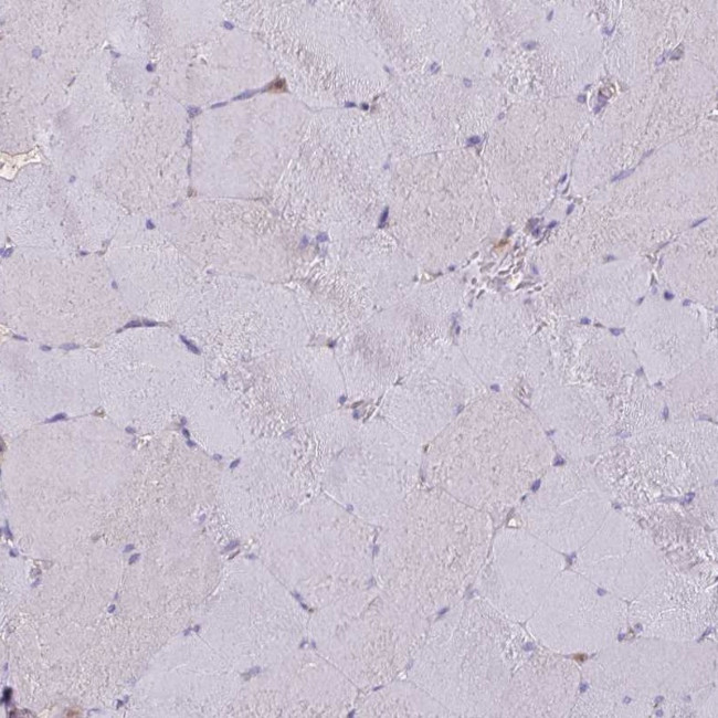 CALML4 Antibody in Immunohistochemistry (IHC)