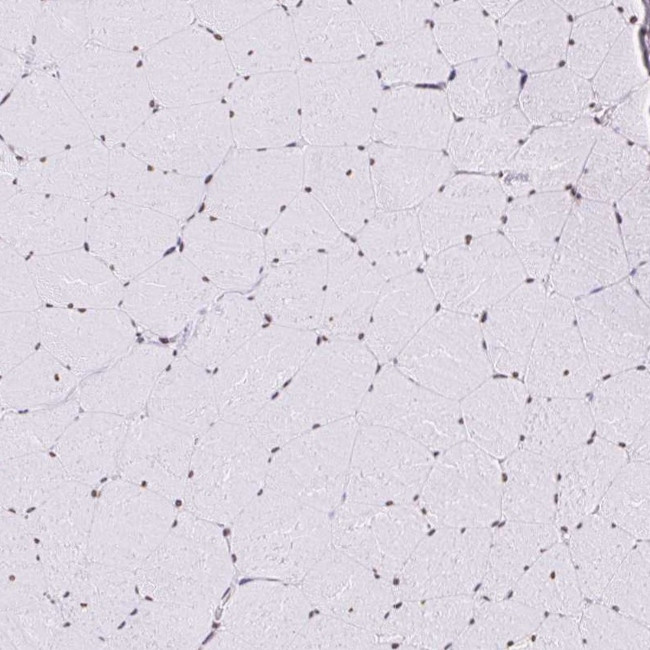 SAM68 Antibody in Immunohistochemistry (IHC)