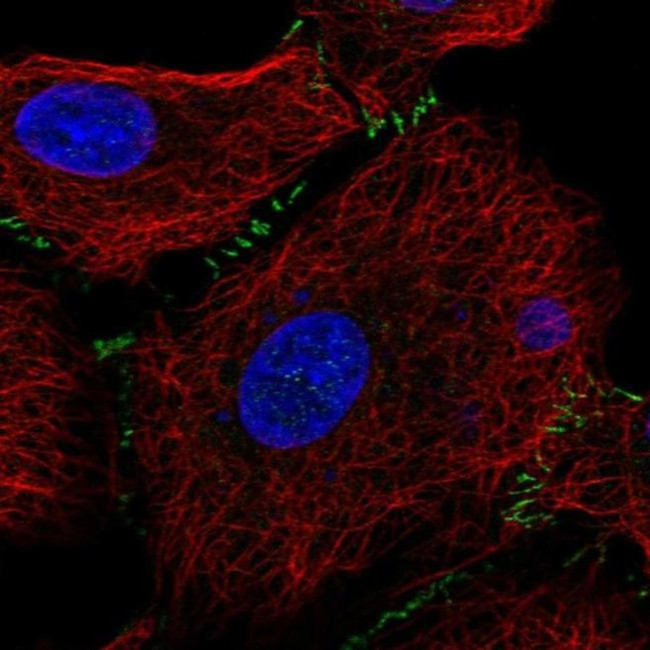 SLC26A9 Antibody in Immunocytochemistry (ICC/IF)