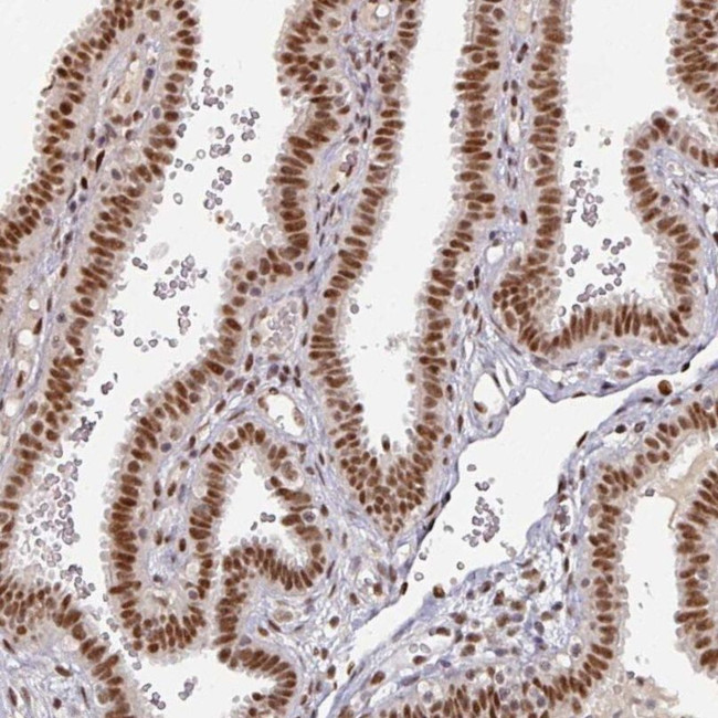 MEPCE Antibody in Immunohistochemistry (IHC)