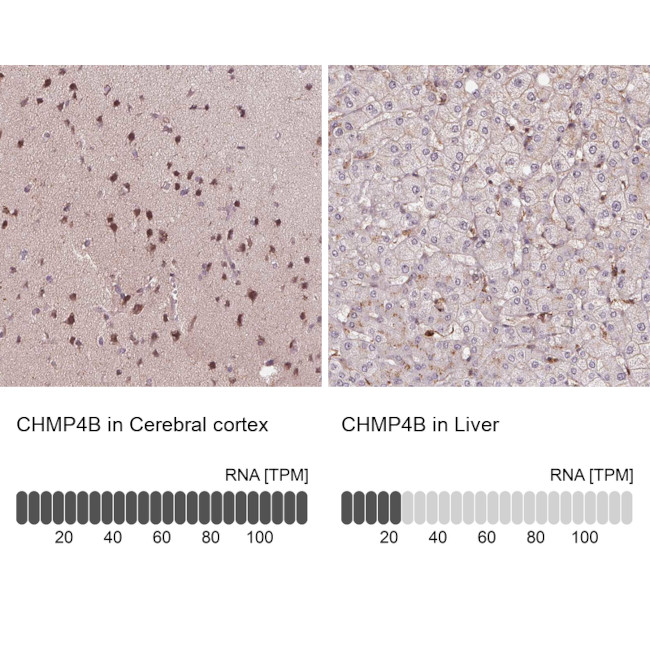 CHMP4B Antibody in Immunohistochemistry (IHC)