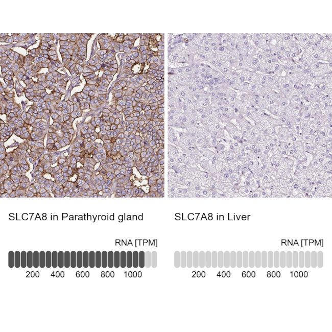 SLC7A8 Antibody in Immunohistochemistry (IHC)