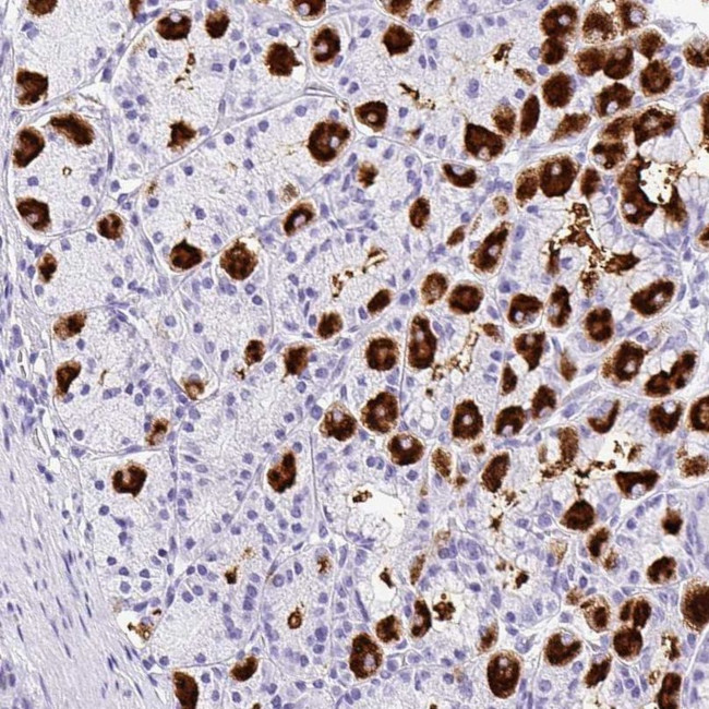 MUC21 Antibody in Immunohistochemistry (IHC)