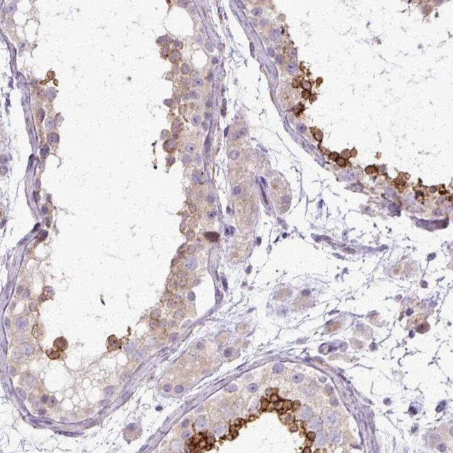 TBC1D3L Antibody in Immunohistochemistry (IHC)