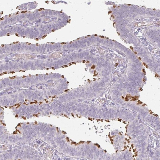 TMEM237 Antibody in Immunohistochemistry (IHC)