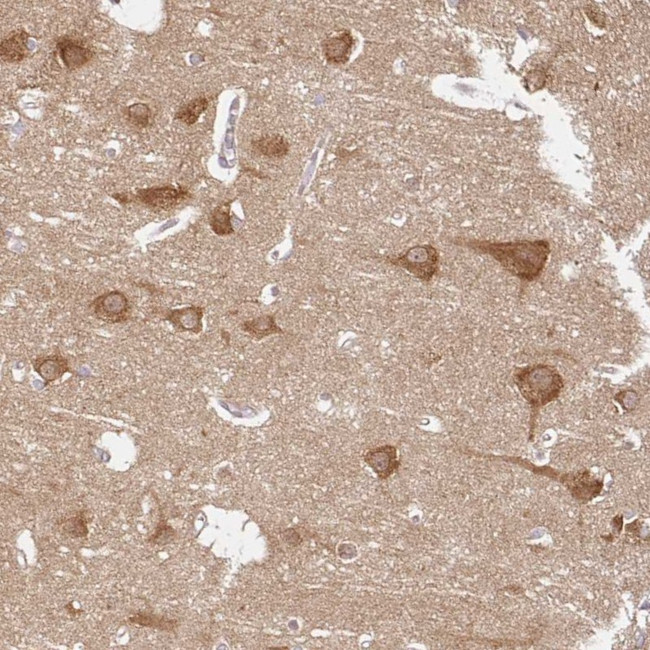 ATP8A1 Antibody in Immunohistochemistry (IHC)