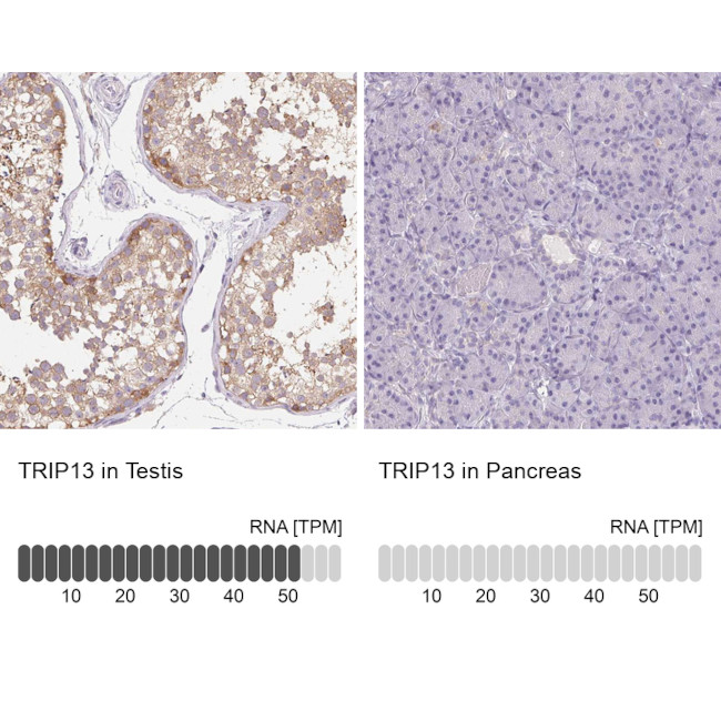 TRIP13 Antibody in Immunohistochemistry (IHC)