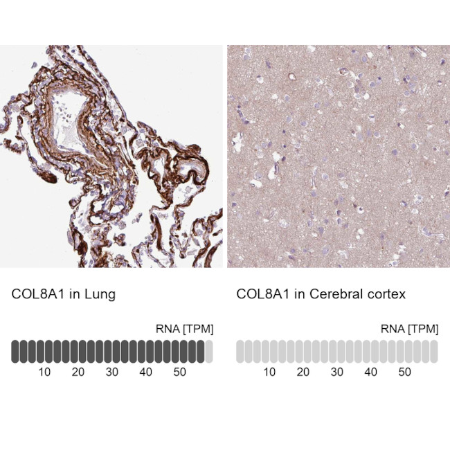 COL8A1 Antibody in Immunohistochemistry (IHC)