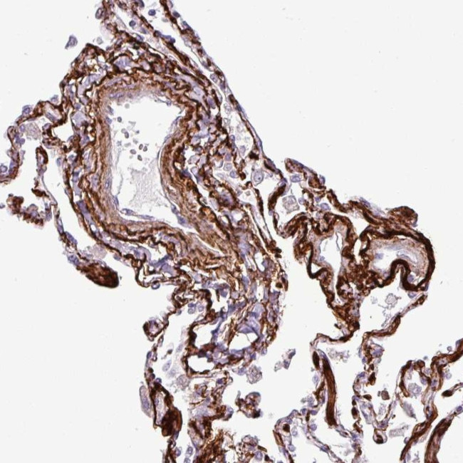 COL8A1 Antibody in Immunohistochemistry (IHC)