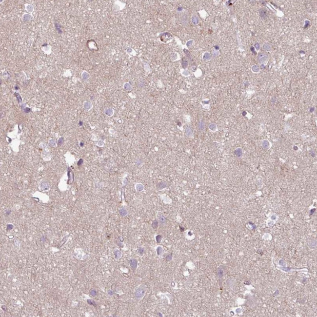 COL8A1 Antibody in Immunohistochemistry (IHC)