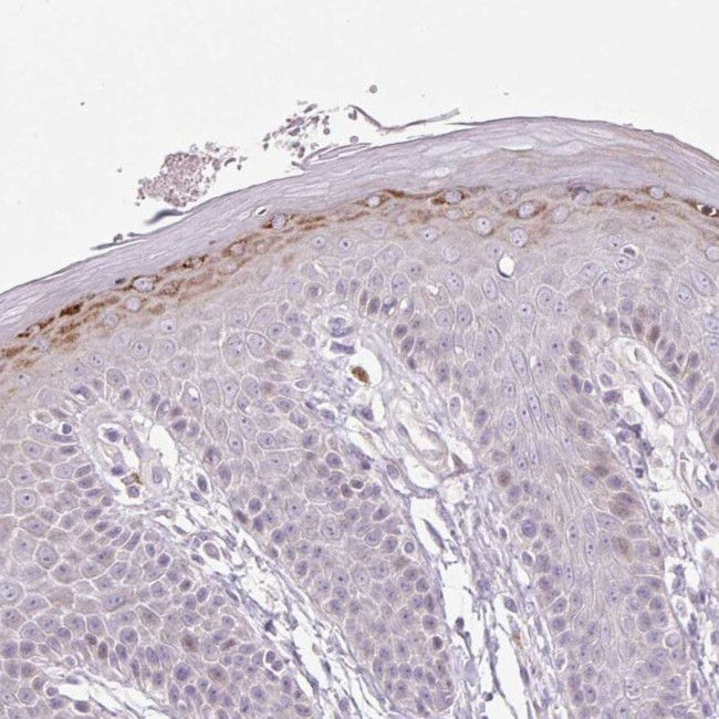 ZNF418 Antibody in Immunohistochemistry (IHC)