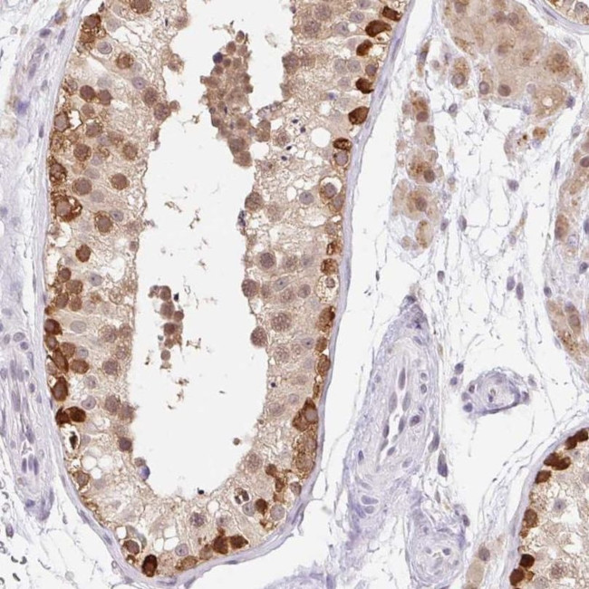 FUSIP1 Antibody in Immunohistochemistry (IHC)