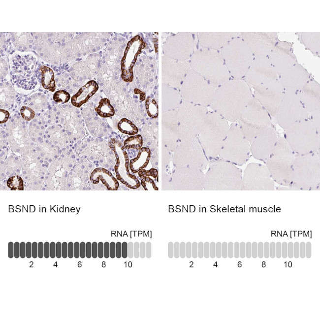 BSND Antibody in Immunohistochemistry (IHC)