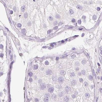 BSND Antibody in Immunohistochemistry (IHC)