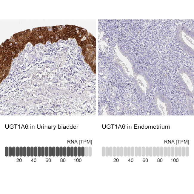 UGT1A6 Antibody in Immunohistochemistry (IHC)