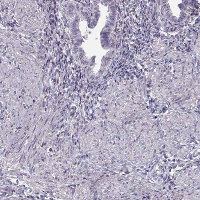 SLCO6A1 Antibody in Immunohistochemistry (IHC)