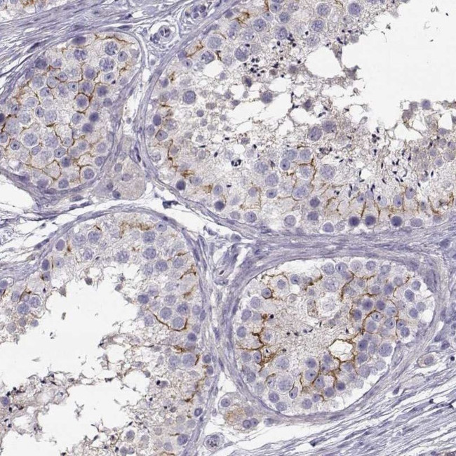 SLCO6A1 Antibody in Immunohistochemistry (IHC)