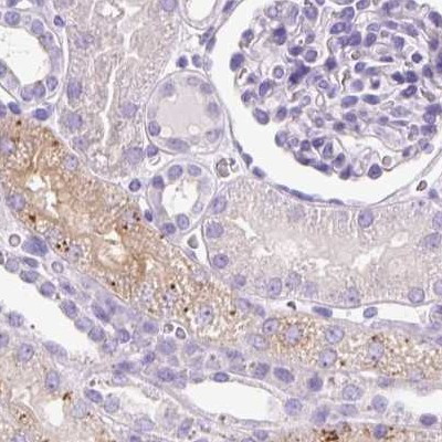 HEXB Antibody in Immunohistochemistry (IHC)