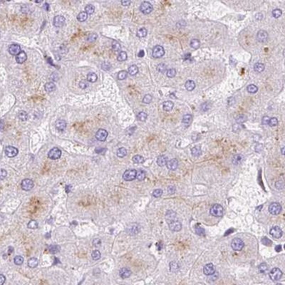 HEXB Antibody in Immunohistochemistry (IHC)