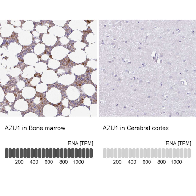 Azurocidin Antibody in Immunohistochemistry (IHC)