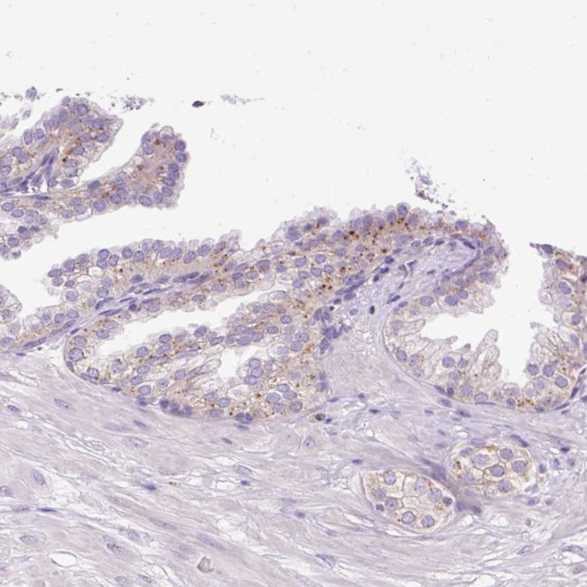 HEXB Antibody in Immunohistochemistry (IHC)