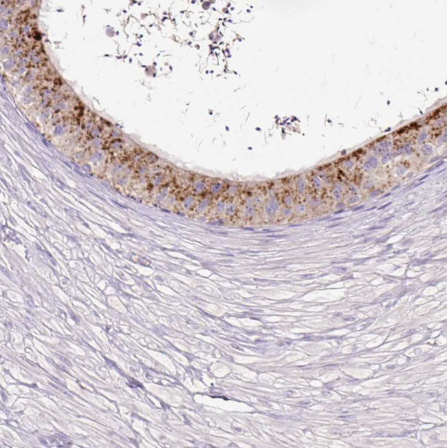 HEXB Antibody in Immunohistochemistry (IHC)