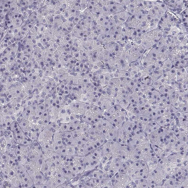 CREB3L3 Antibody in Immunohistochemistry (IHC)