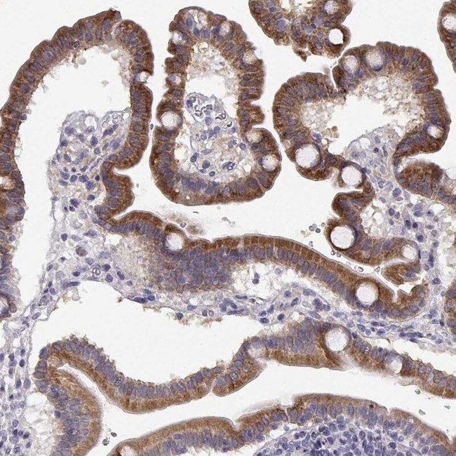 CREB3L3 Antibody in Immunohistochemistry (IHC)