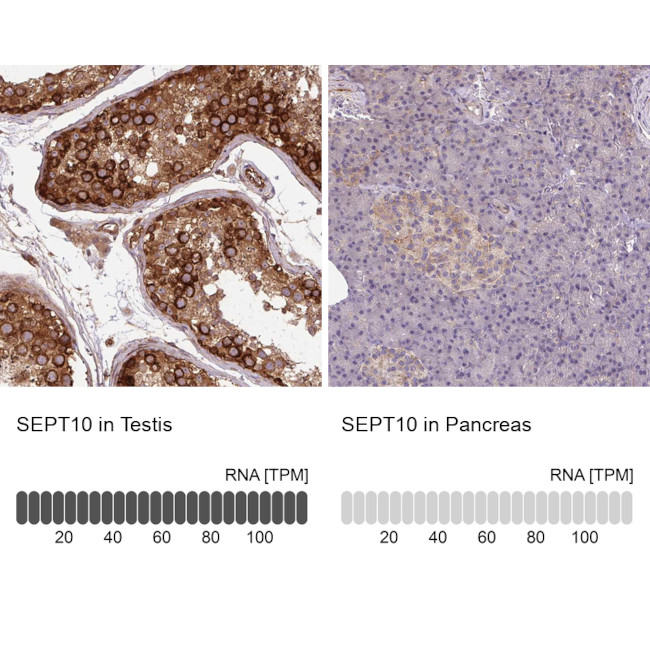 Septin-10 Antibody in Immunohistochemistry (IHC)