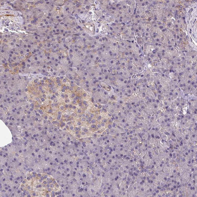 Septin-10 Antibody in Immunohistochemistry (IHC)