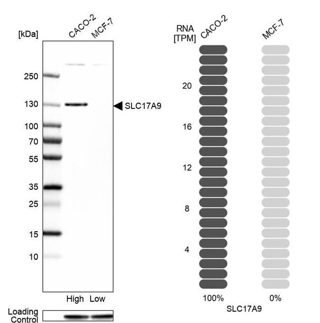 SLC17A9 Antibody in Western Blot (WB)