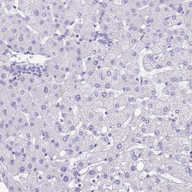 PGM2L1 Antibody in Immunohistochemistry (IHC)