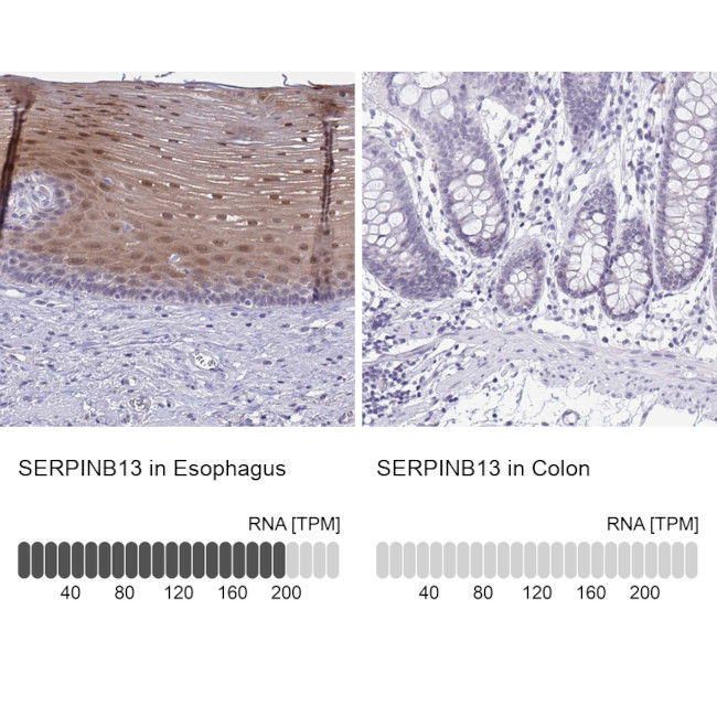 SERPINB13 Antibody in Immunohistochemistry (IHC)