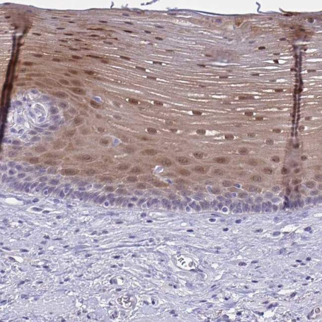 SERPINB13 Antibody in Immunohistochemistry (IHC)