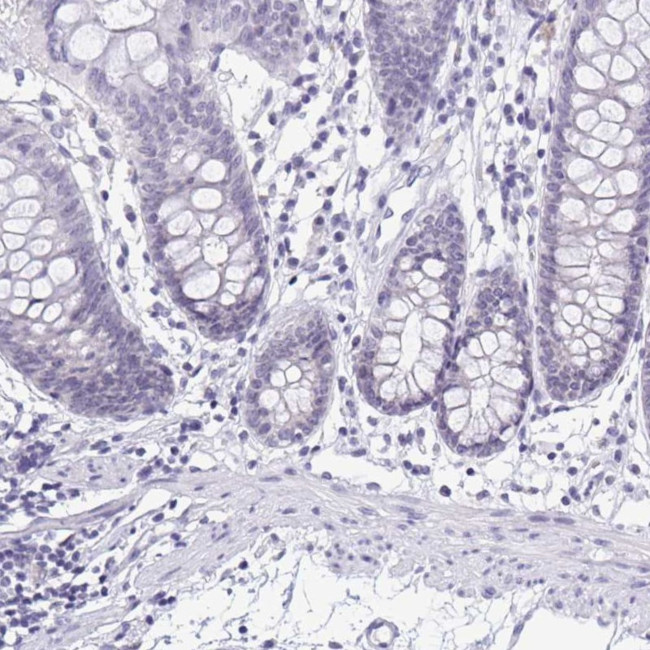 SERPINB13 Antibody in Immunohistochemistry (IHC)