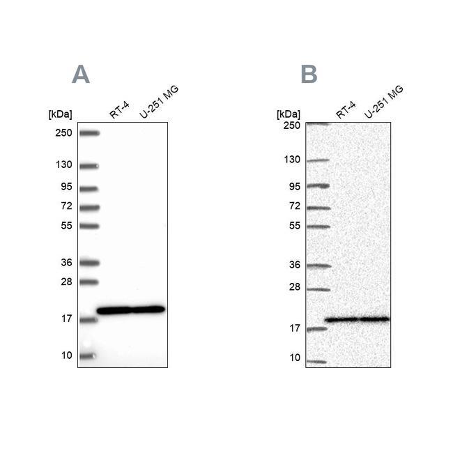 RPS15 Antibody in Western Blot (WB)