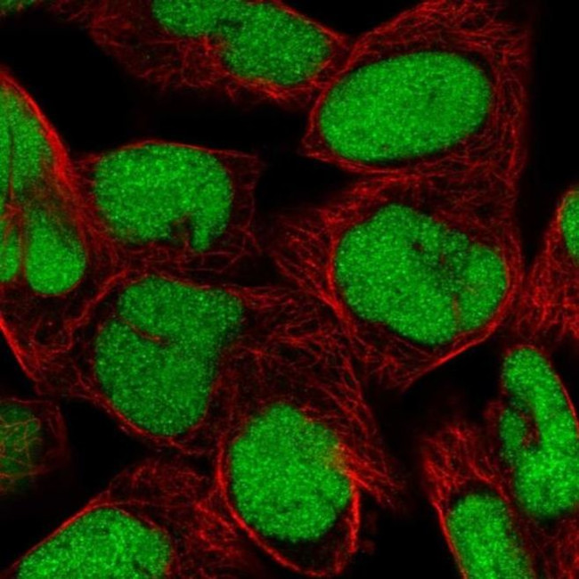 DEK Antibody in Immunocytochemistry (ICC/IF)