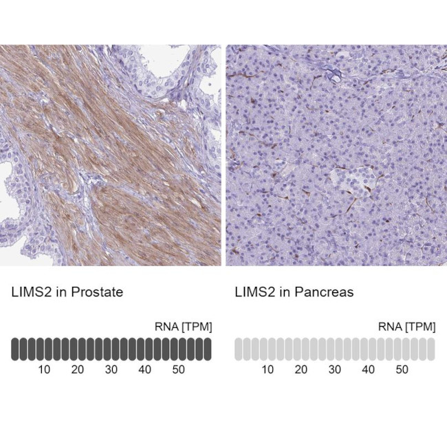 LIMS2 Antibody