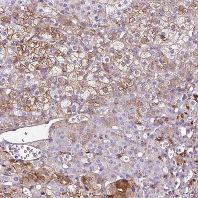 NGB Antibody in Immunohistochemistry (IHC)