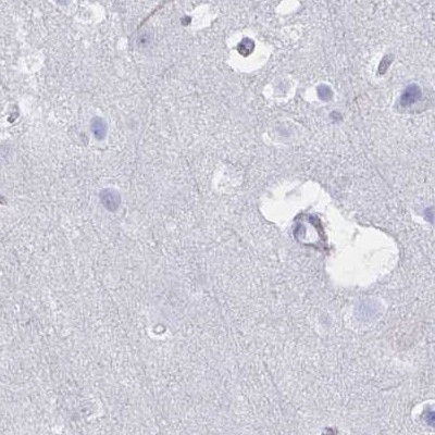 DPEP3 Antibody in Immunohistochemistry (IHC)